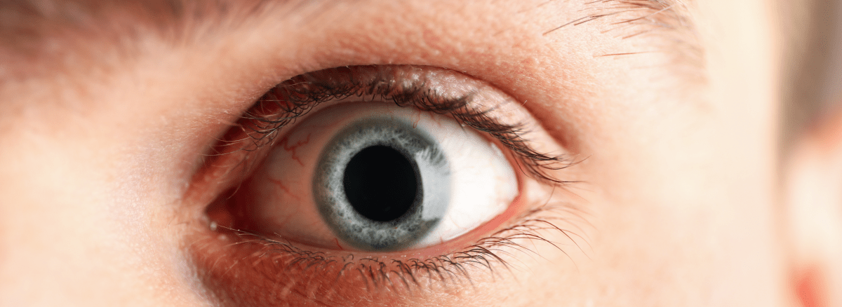 Conheça as principais doenças mais graves causadas nos olhos